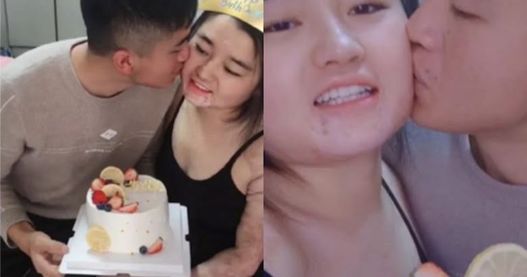 Le « petit ami féerique » d’une femme chinoise défigurée devient viral